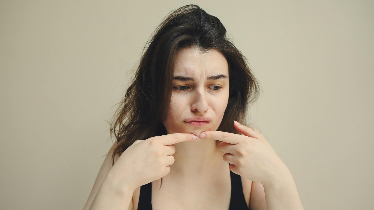 Cara menenangkan jerawat dengan sangat cepat