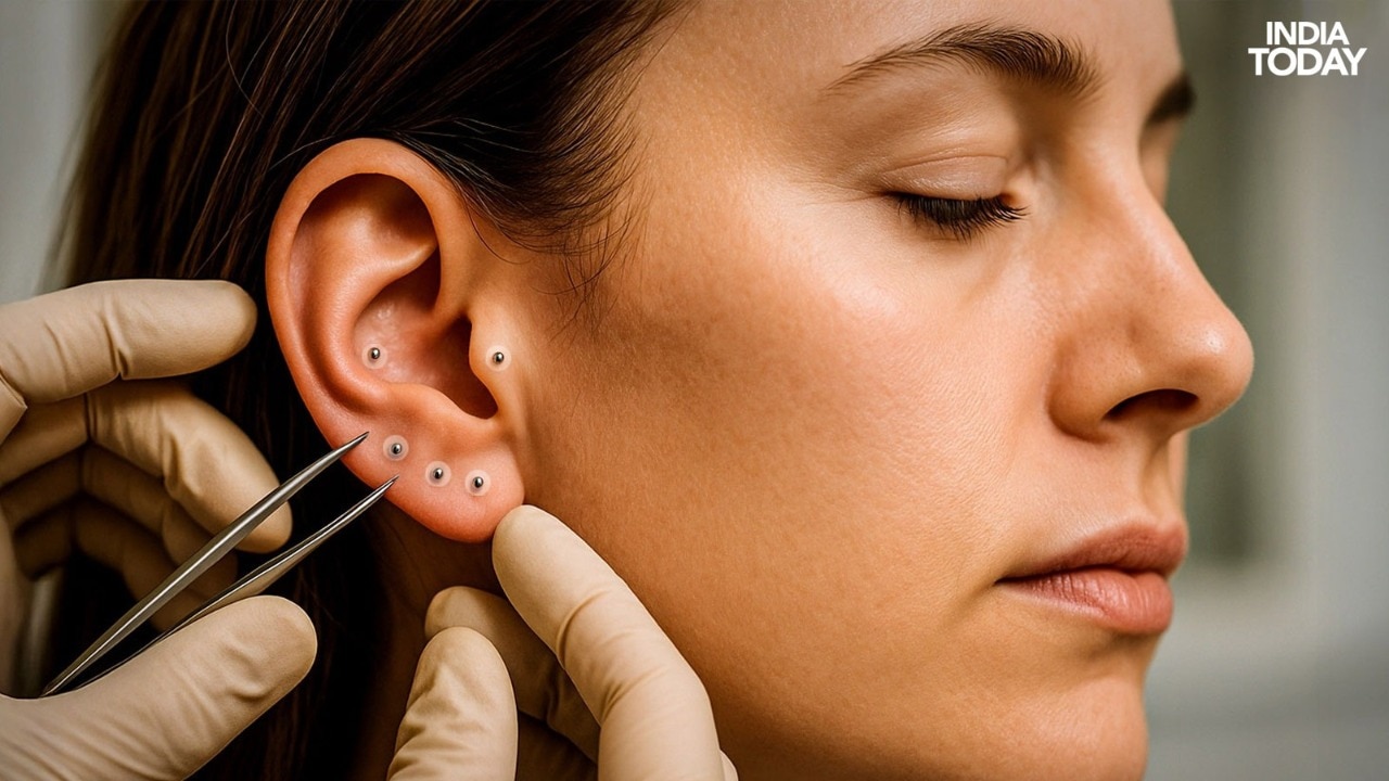 Manik -manik kecil penyemaian telinga membuat kebisingan besar di dunia kesehatan