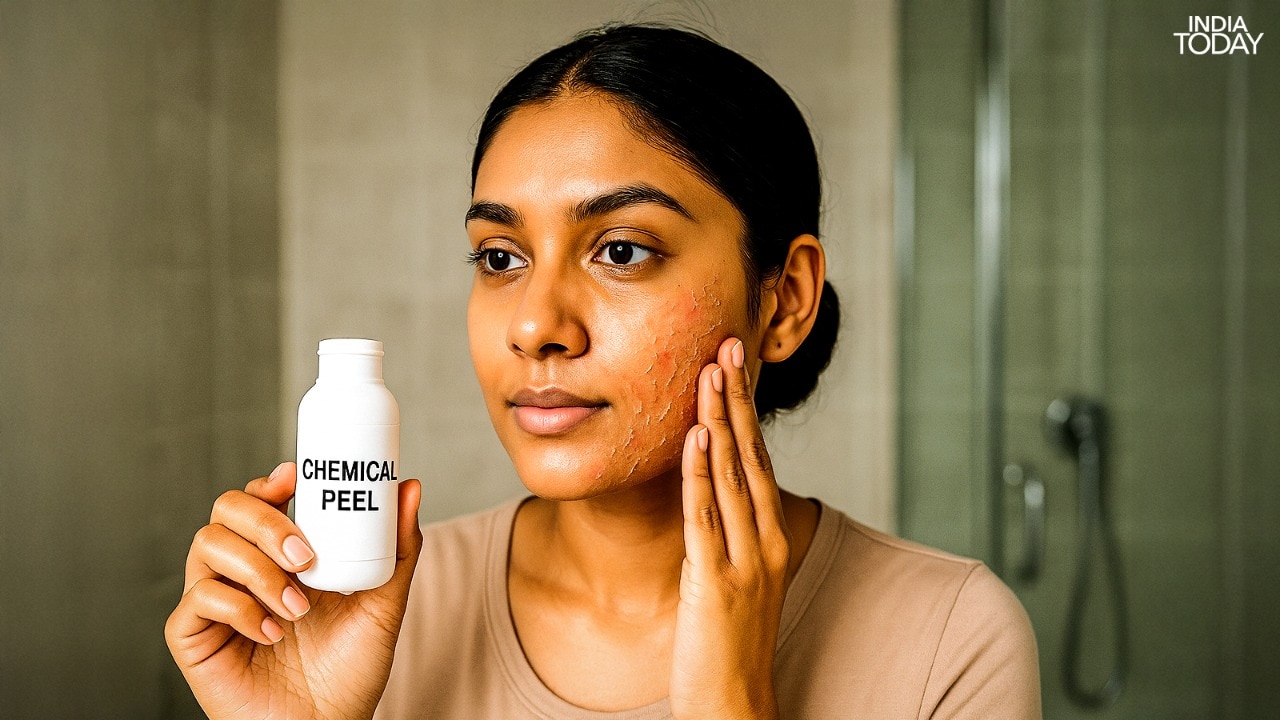 Mengapa kulit kimia DIY adalah risiko yang tidak boleh Anda ambil